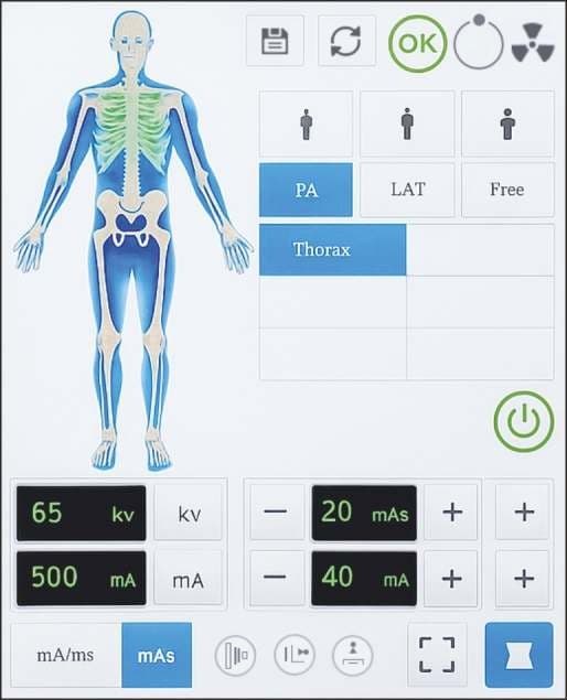 HF Mobile X-Ray (5kW / 6kW / 7kW) thumbnail 3
