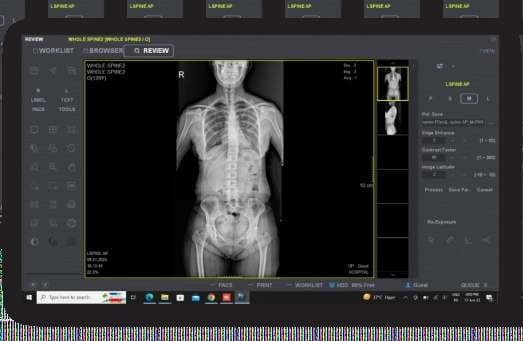 Integrated Digital Mobile X-Ray — 6i thumbnail 2