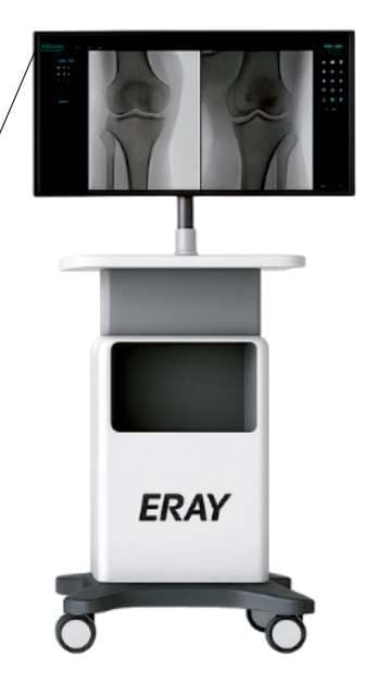 Premium Digital Mobile C-Arm — 5C thumbnail 3