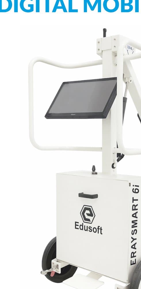 Integrated Digital Mobile X-Ray — 6i